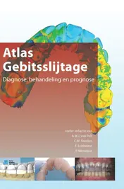 Omslag van Atlas gebitsslijtage