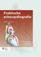 Omslag van Praktische echocardiografie