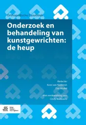Omslag van Kunstgewrichten: de heup