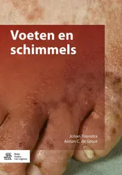 Omslag van Voeten en schimmels