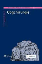 Omslag van Oogchirurgie