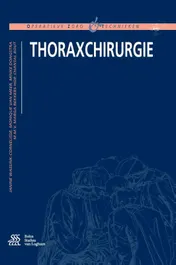 Omslag van Thoraxchirurgie
