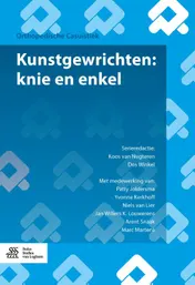 Omslag van Kunstgewrichten: knie en enkel