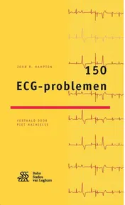 Omslag van 150 ECG-problemen