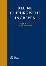 Omslag van Kleine chirurgische ingrepen