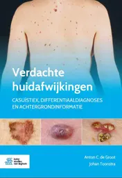 Omslag van Verdachte huidafwijkingen