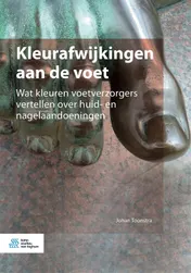 Omslag van Kleurafwijkingen aan de voet
