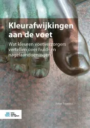 Omslag van Kleurafwijkingen aan de voet
