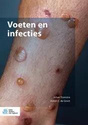 Omslag van Voeten en infecties