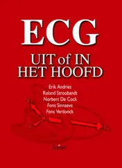 Omslag van ECG. Uit of in het hoofd