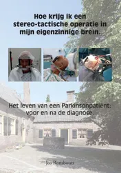 Omslag van Hoe krijg ik een stereo-tactische operatie in mijn eigenzinnige brein.