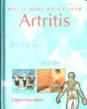 Omslag van Artritis