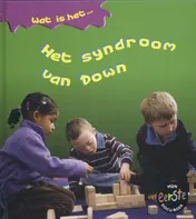 Omslag van Het syndroom van Down