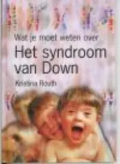 Omslag van Het syndroom van Down