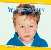 Omslag van Waterpokken