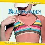 Omslag van Brandwonden