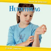 Omslag van Huiduitslag