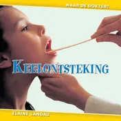 Omslag van Keelontsteking