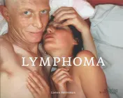 Omslag van Lymphoma