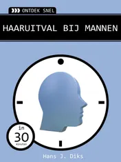 Omslag van Haaruitval bij mannen