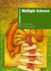 Omslag van Multiple sclerose