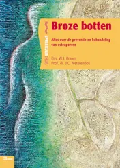 Omslag van Broze botten