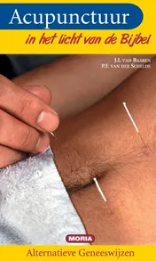 Omslag van Acupunctuur