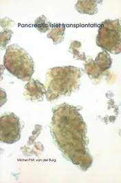 Omslag van Pancreatic islet transplantation