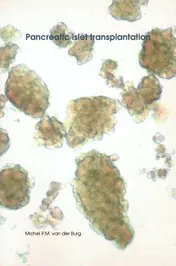 Omslag van Pancreatic islet transplantation