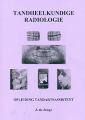 Omslag van Tandheelkundige radiologie