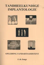Omslag van Tandheelkundige Implantologie