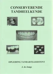 Omslag van Conserverende Tandheelkunde
