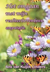 Omslag van het omgaan met mijn rechter bovenbeen amputatie
