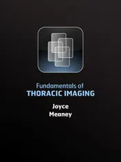 Omslag van Fundamentals of thoracic imaging