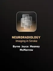 Omslag van Imaging in stroke