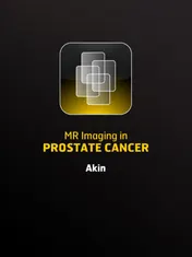 Omslag van Mr imaging in prostate cancer