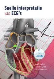 Omslag van Snelle interpretatie van ECG's