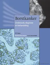 Omslag van Borstkanker
