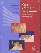 Omslag van Vezelversterkte composieten