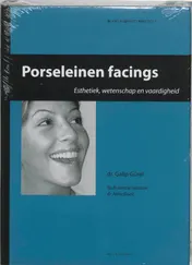 Omslag van Porseleinen facings
