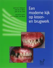 Omslag van Een moderne kijk op kroon- en brugwerk
