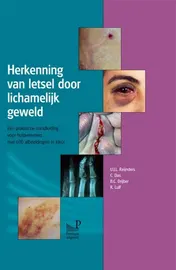 Omslag van Herkenning van letsel door lichamelijk geweld