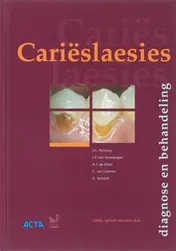 Omslag van Carieslaesies