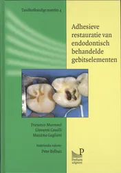 Omslag van Adhesieve restauratie van endodontisch behandelde gebitselementen