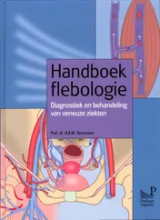 Omslag van Handboek flebologie