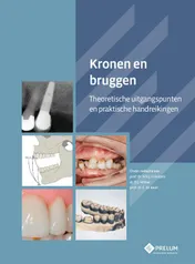 Omslag van Kronen en bruggen