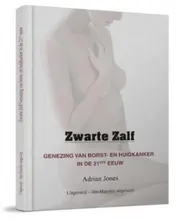 Omslag van Zwarte Zalf