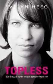 Omslag van Topless