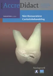 Omslag van Niet-restauratieve caviteitsbehandeling
