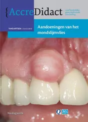 Omslag van Aandoeningen van het mondslijmvlies